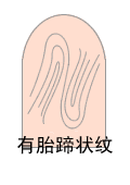 指纹类型大全