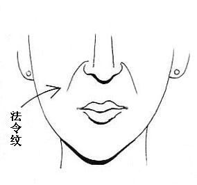 详解:法令纹是什么?