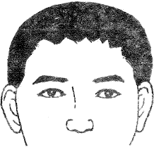 额头发际线参差不齐